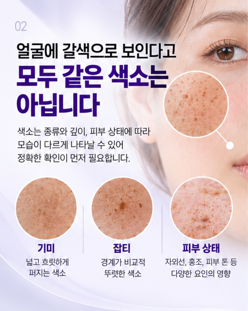 레이저토닝, 기미가 반복된다면 먼저 확인할 것 | 울산삼산스타케이의원 사진 2