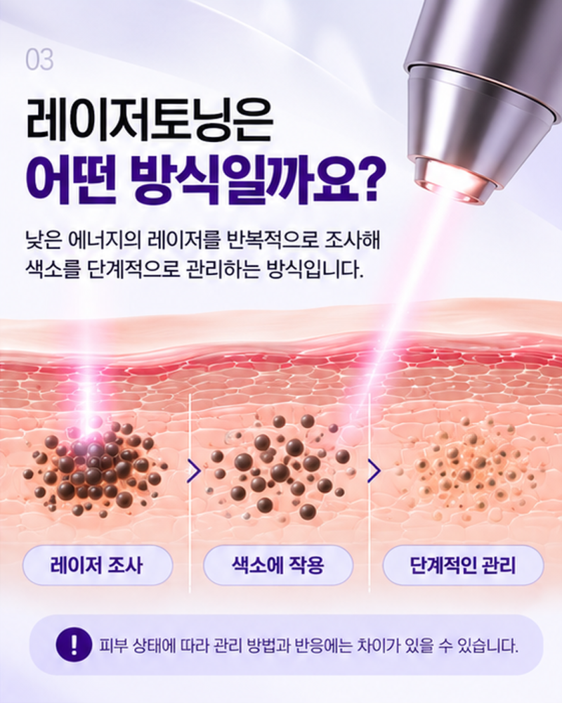 레이저토닝, 기미가 반복된다면 먼저 확인할 것 | 울산삼산스타케이의원 사진 3