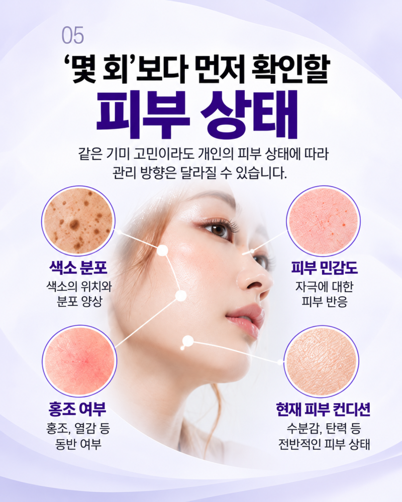 레이저토닝, 기미가 반복된다면 먼저 확인할 것 | 울산삼산스타케이의원 사진 5